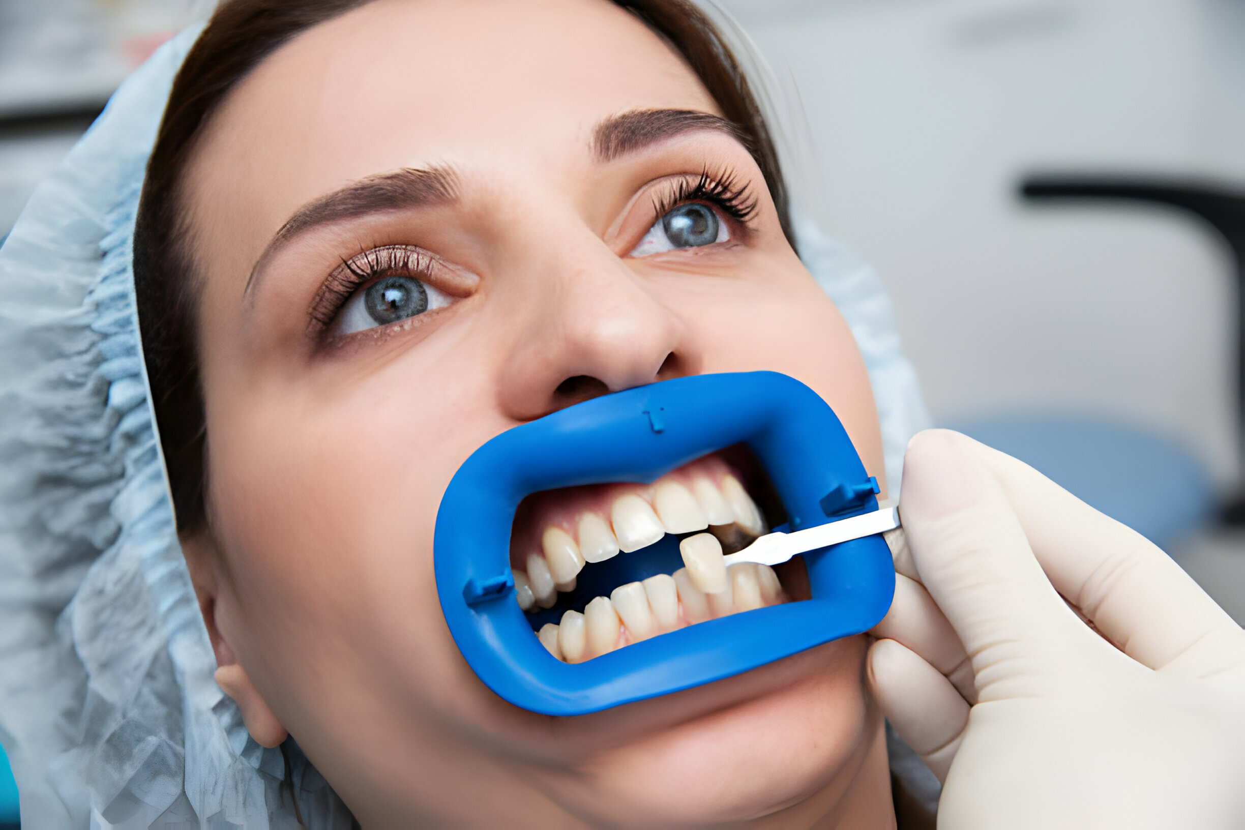 Know Everything About Dental Veneers Treatment in Kansas_1