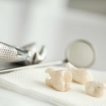 What to Expect During a Tooth Extraction at the Dental Care Center of South Kansas City_FI