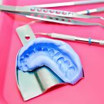 How Dental Care Center of South Kansas City Transforms Smiles with Restorative Dentistry