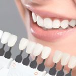 Dental Crowns in Kansas City, MO: How They Protect and Restore Your Smile_FI